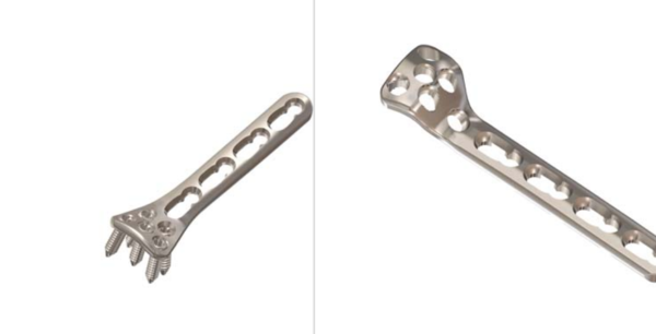 AS. Radial Head Plate
